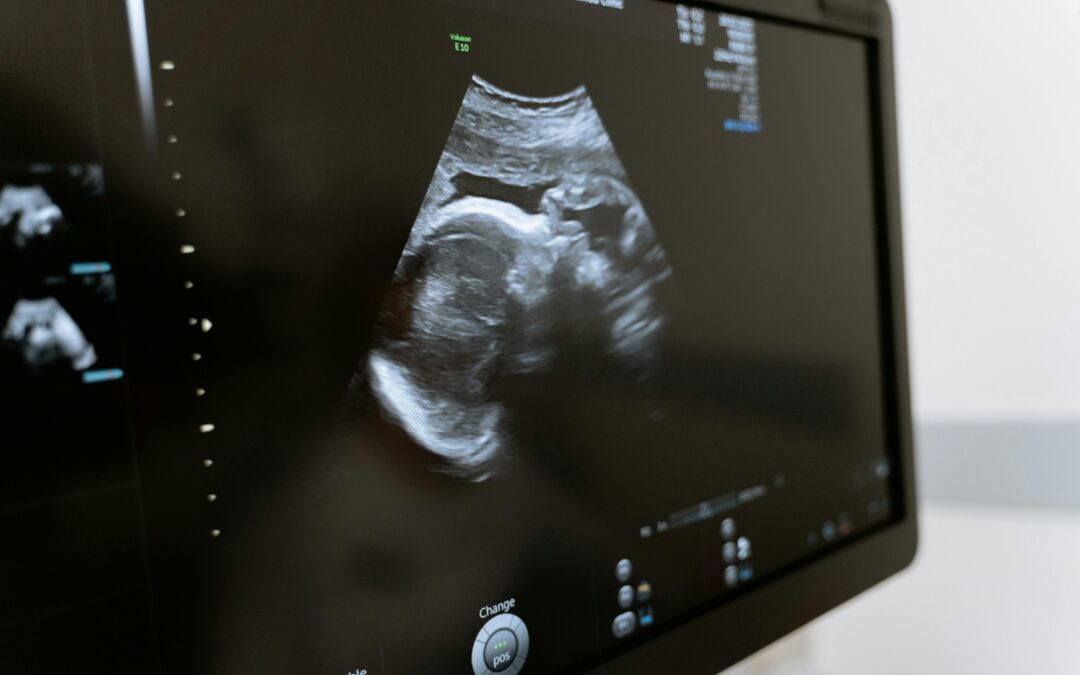 King County Doubles Down on Radical Abortion Agenda—At Taxpayer Expense